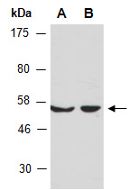 MMP28 Antibody Western (Abiocode)