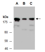 SPAG9 Antibody Western (Abiocode)