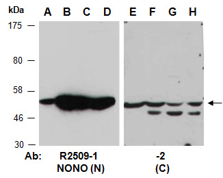 NONO Antibody Western (Abiocode)