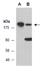 BRD4 Antibody Western (Abiocode)