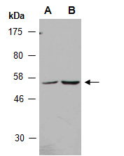 PDK3 Antibody Western (Abiocode)