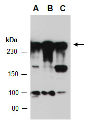 SPTBN1 Antibody Western (Abiocode)