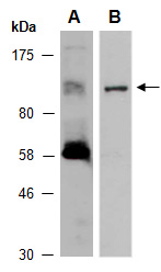 GI Antibody Western (Abiocode)