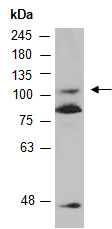 TMK3 Antibody Western (Abiocode)