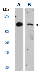 TMK1 Antibody Western (Abiocode)