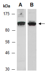 TMK4 Antibody Western (Abiocode)