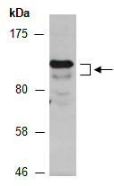 TMK1/2/3/4 Antibody Western (Abiocode)