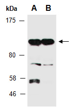 DIAPH3 Antibody Western (Abiocode)