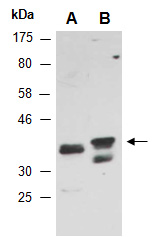 MSI2 Antibody Western (Abiocode)