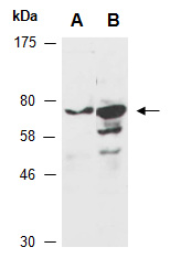 METTL3 Antibody Western (Abiocode)