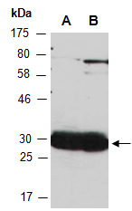 VTI1A Antibody Western (Abiocode)
