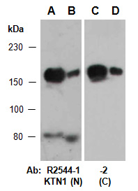 KTN1 Antibody Western (Abiocode)