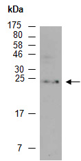 TIM1 Antibody Western (Abiocode)
