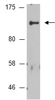 FER Antibody Western (Abiocode)