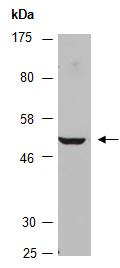 DRD2 Antibody Western (Abiocode)