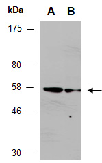 MMP19 Antibody Western (Abiocode)
