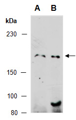 LTBP1 Antibody Western (Abiocode)