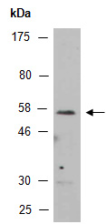 MEF2C Antibody Western (Abiocode)
