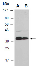 PDXK Antibody Western (Abiocode)