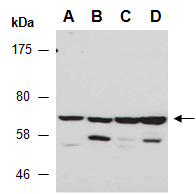 FNBP1 Antibody Western (Abiocode)