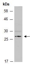 NFYB9 Antibody Western (Abiocode)