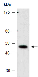 ETV1 Antibody Western (Abiocode)