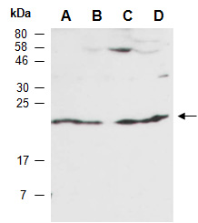 RAB7L1 Antibody Western (Abiocode)