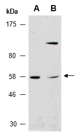 TRIM27 Antibody Western (Abiocode)