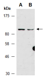 RNF219 Antibody Western (Abiocode)