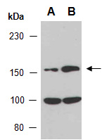 ABCC3 Antibody Western (Abiocode)