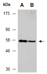 MEF2D Antibody Western (Abiocode)