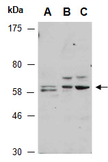 PRKAA2 Antibody Western (Abiocode)