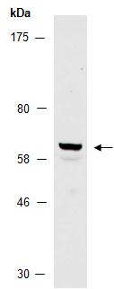 ZIC5 Antibody Western (Abiocode)