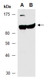 EXOSC10 Antibody Western (Abiocode)