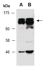 RBM10 Antibody Western (Abiocode)