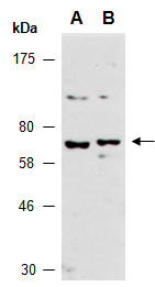 EPN2 Antibody Western (Abiocode)