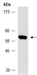 EPN2 Antibody Western (Abiocode)