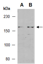 SHANK3 Antibody Western (Abiocode)