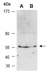 SCARB1 Antibody Western (Abiocode)