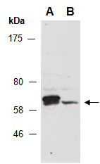 NR1D2 Antibody Western (Abiocode)