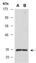 STK19 Antibody Western (Abiocode)