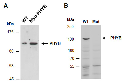 PHYB Antibody Western (Abiocode)