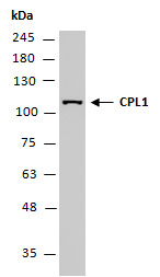 CPL1 (FRY2) Antibody Western (Abiocode)
