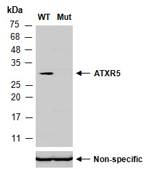 ATXR5 Antibody Western (Abiocode)