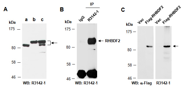 RHBDF2 iRhom2 Antibody Western (Abiocode)
