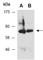 TBR1 Antibody Western (Abiocode)