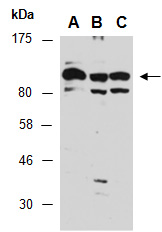 EIF2AK3 Antibody Western (Abiocode)