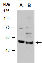 BECN2 Antibody Western (Abiocode)