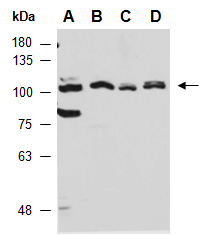 XRN2 Antibody Western (Abiocode)