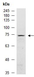 DDX5 Antibody Western (Abiocode)